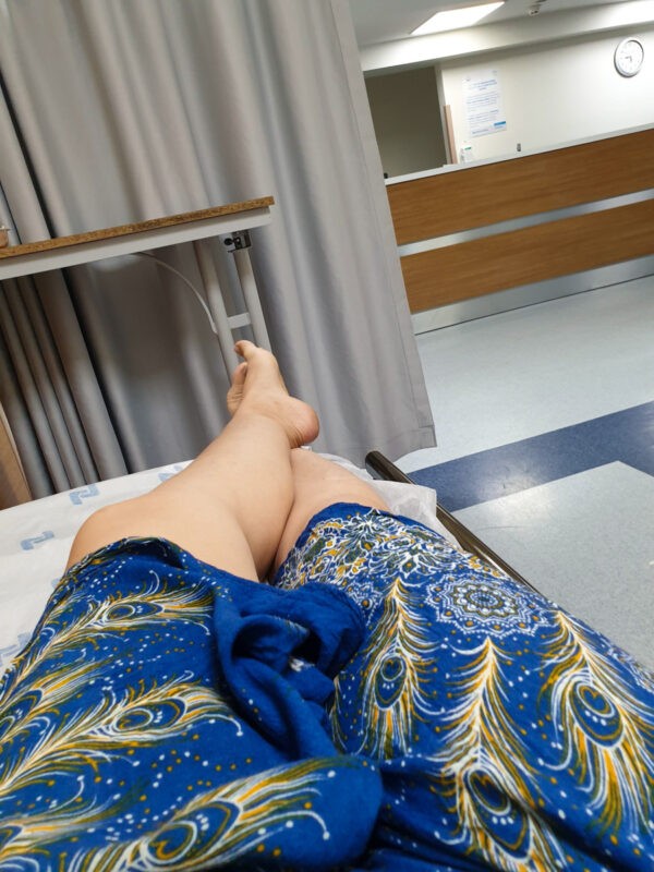 A person lying on a hospital bed with a blue patterned gown, showing their legs stretched out, in a room with medical equipment and a curtain divider.